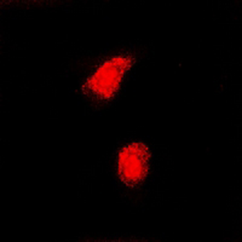 CAF-I p60 Antibody
