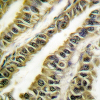 ABL1/2 Antibody