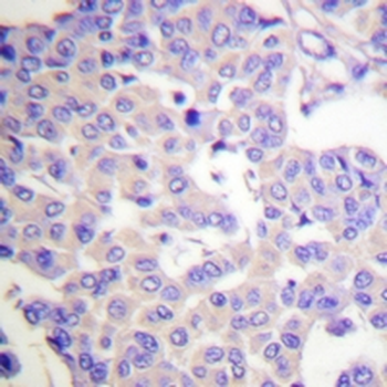 Synaptotagmin (pS309/306) Antibody