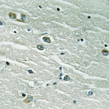 MERTK/TYRO3 Antibody