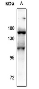 Aconitase 1 (pS138) Antibody