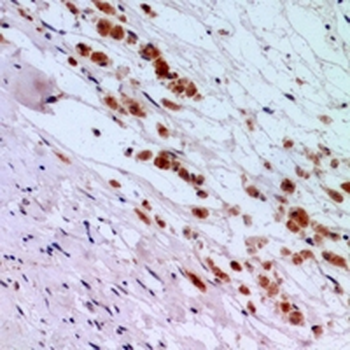 IFNAR2 Antibody