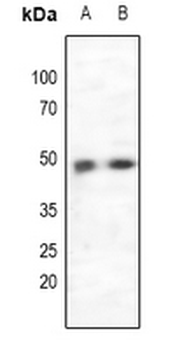 CCR5 Antibody