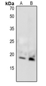 MBP (pT232) Antibody
