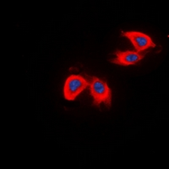 DCLK2 Antibody