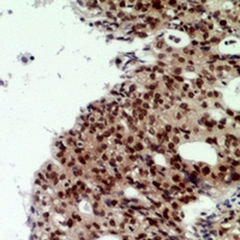 CNOT7 Antibody
