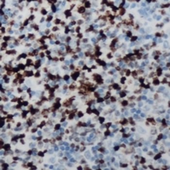 CCNB1IP1 Antibody