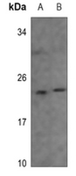 Recoverin Antibody