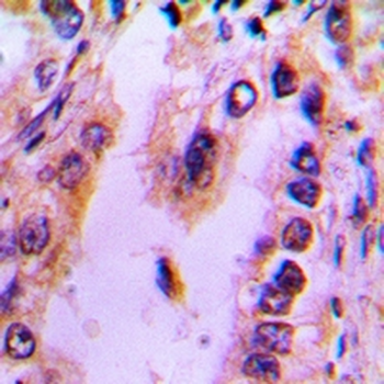 Recoverin Antibody
