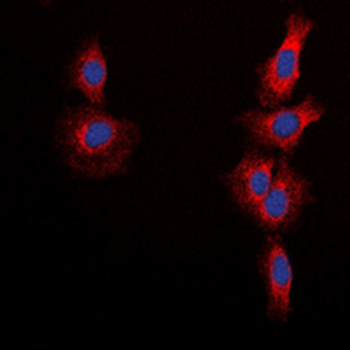 mTOR (pS2448) Antibody