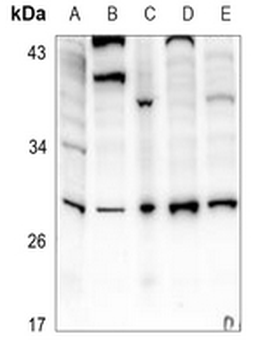 IL-6 Antibody