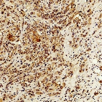 IL-6 Antibody