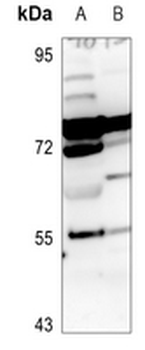 ARHGEF7 Antibody