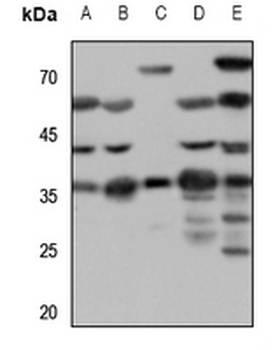 SSTR1 Antibody