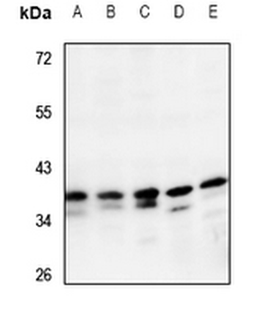 CRSP8 Antibody