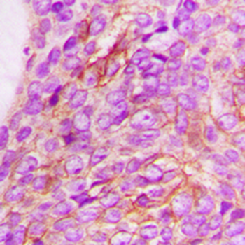 CD213a1 Antibody
