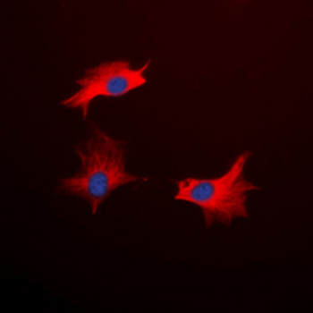 CD213a1 Antibody