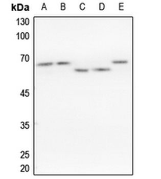 hnRNP K Antibody