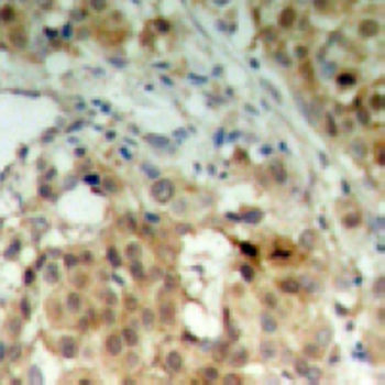 hnRNP K Antibody