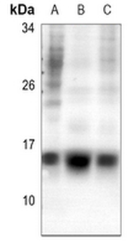 Histone H2A.Z (AcK5) Antibody