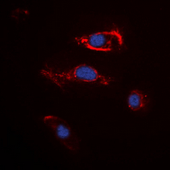 FGF22 Antibody
