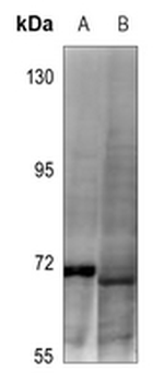 DDX5 (pY593) Antibody