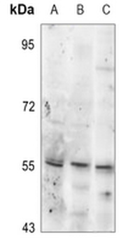 Tyrosine Hydroxylase (pS19) Antibody