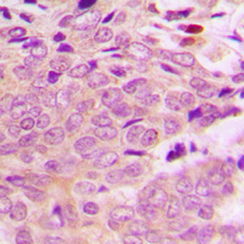 MRPL40 Antibody