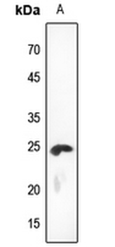 KDELR2 Antibody