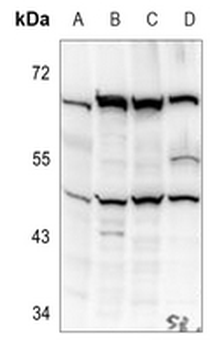 Kir2.1 Antibody