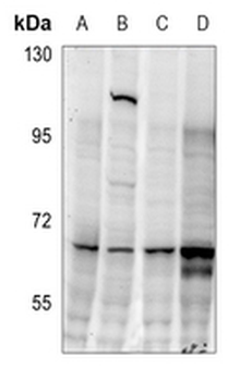CDC25C (pS216) Antibody