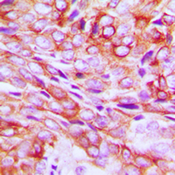 TMBIM1 Antibody