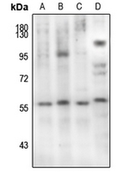 SMAD2 (pS467) Antibody