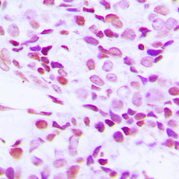 hnRNP G Antibody
