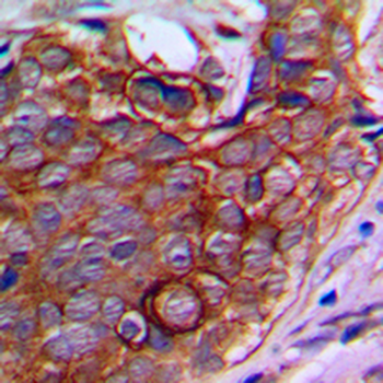 NPDC1 Antibody