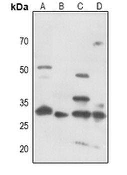 CDK5 (pY15) Antibody