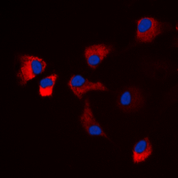 CaMK2 alpha/delta (pT286) Antibody