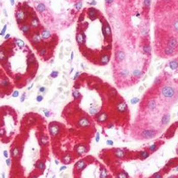 Aquaporin 2 Antibody