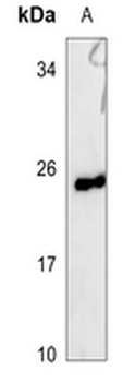UBE2E3 Antibody