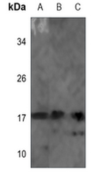 NDUFB7 Antibody