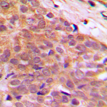 CABLES1 Antibody