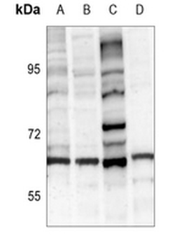 Tyrosine Hydroxylase Antibody