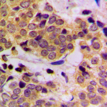 SHPTP2 (pY542) Antibody