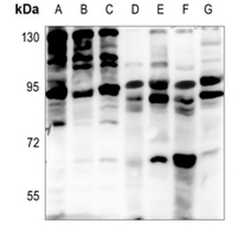 EPS8L2 Antibody