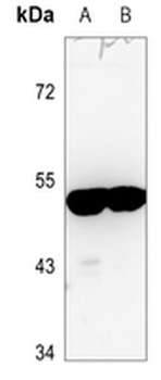 ARRDC3 Antibody