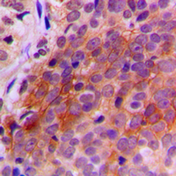 TXNRD2 Antibody