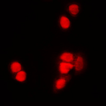 Histone H3 (AcK9) Antibody