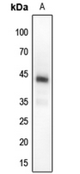 MKK4 (pT261) Antibody