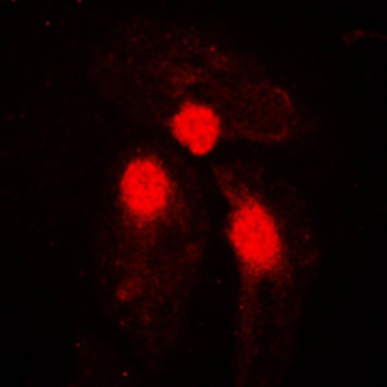 SMAD3 (pS204) Antibody