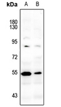 LCK (pY393) Antibody